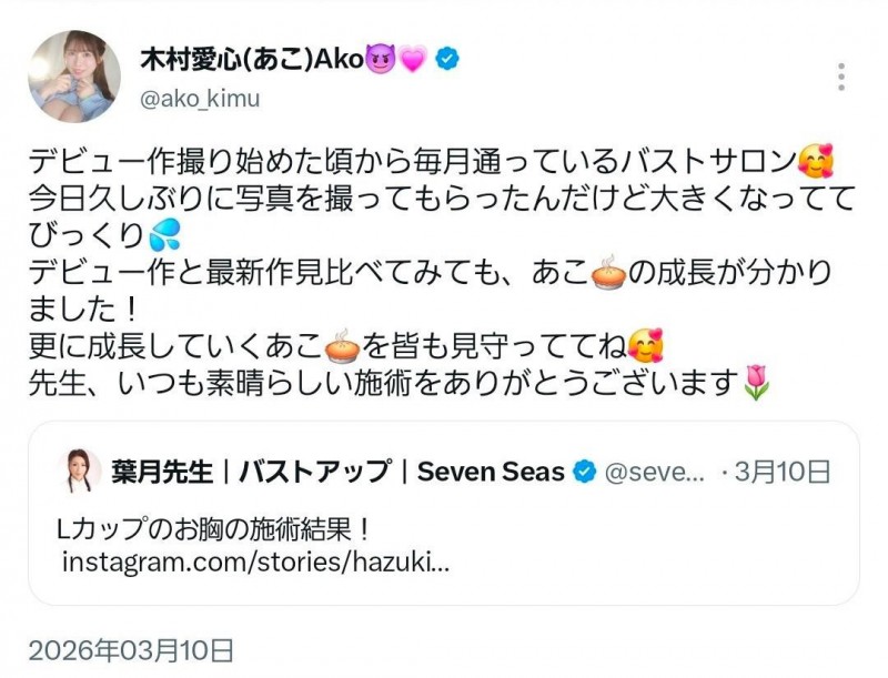 【美天棋牌】被指隆乳不忍了!木村爱心直球对决! 【美天棋牌】被指隆乳不忍了!木村爱心直球对决!